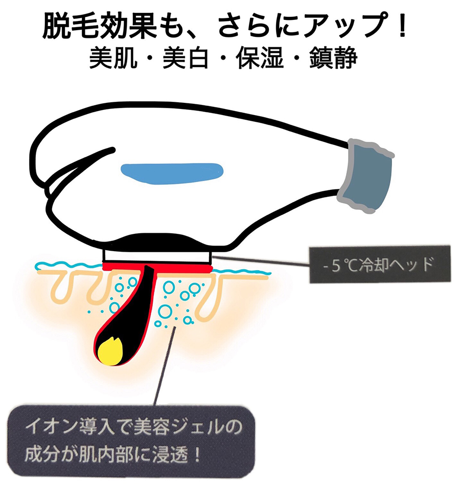 世界初のイオン導入しながら脱毛できる美肌脱毛です。